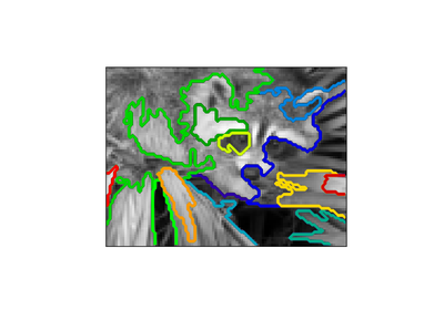 ../_images/sphx_glr_plot_face_ward_segmentation_thumb.png